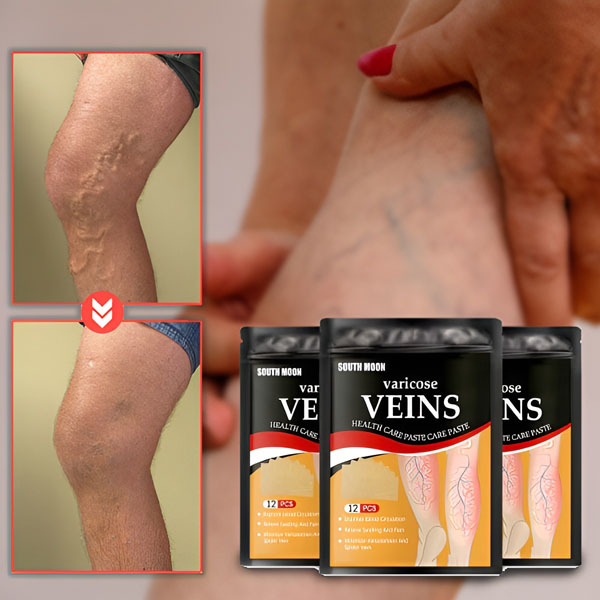 VEINPAT